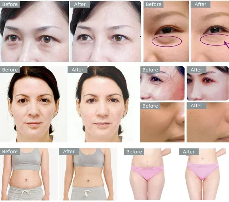 Moonic Beauty 40K Cavitation Ultrasonic 3in1 Body Shaping