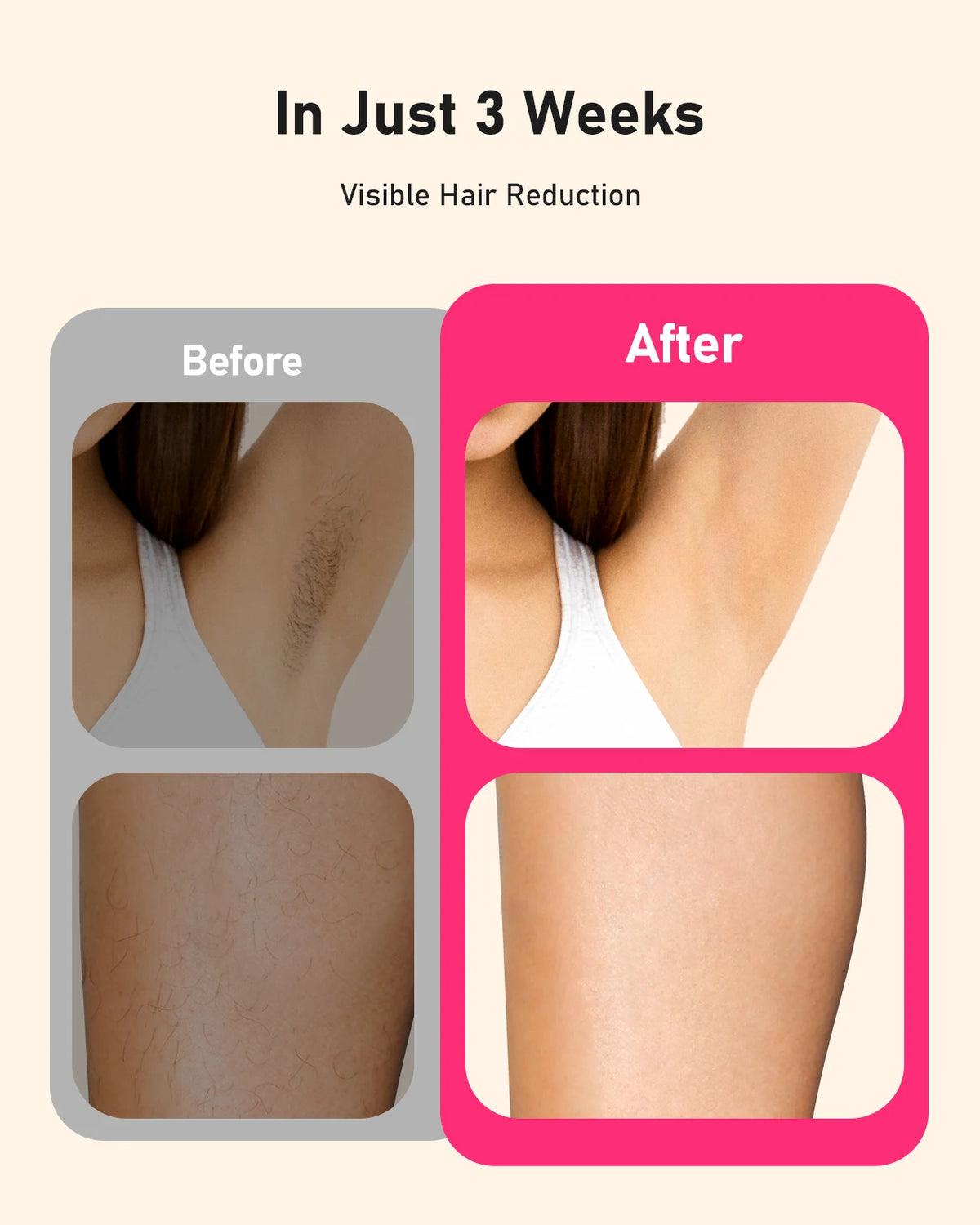 Laser Hair Removal 999999+ Fast flashes 3 In 1 IPL At Home Hair Remover Machine for Women Men Permanent Epilator on Face Body